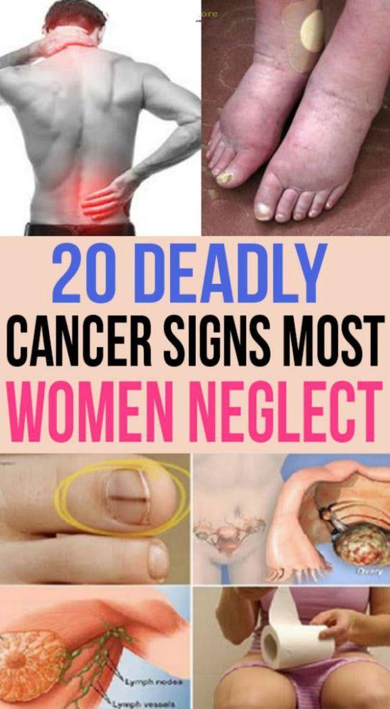 20 Signs Of Cancer Ignored By Women Awarenesses