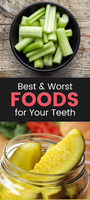 The Best and Worst Foods for Your Teeth | Awarenesses