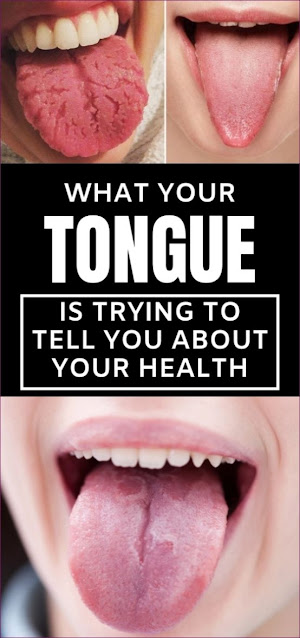 What Your Tongue Is Trying To Tell You About Your Health | Awarenesses