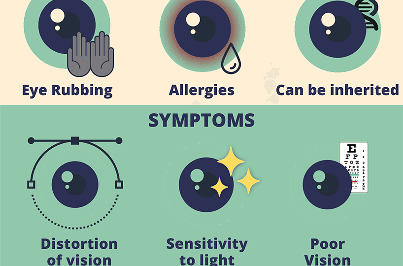 What is Keratoconus (Infographic) | Awarenesses